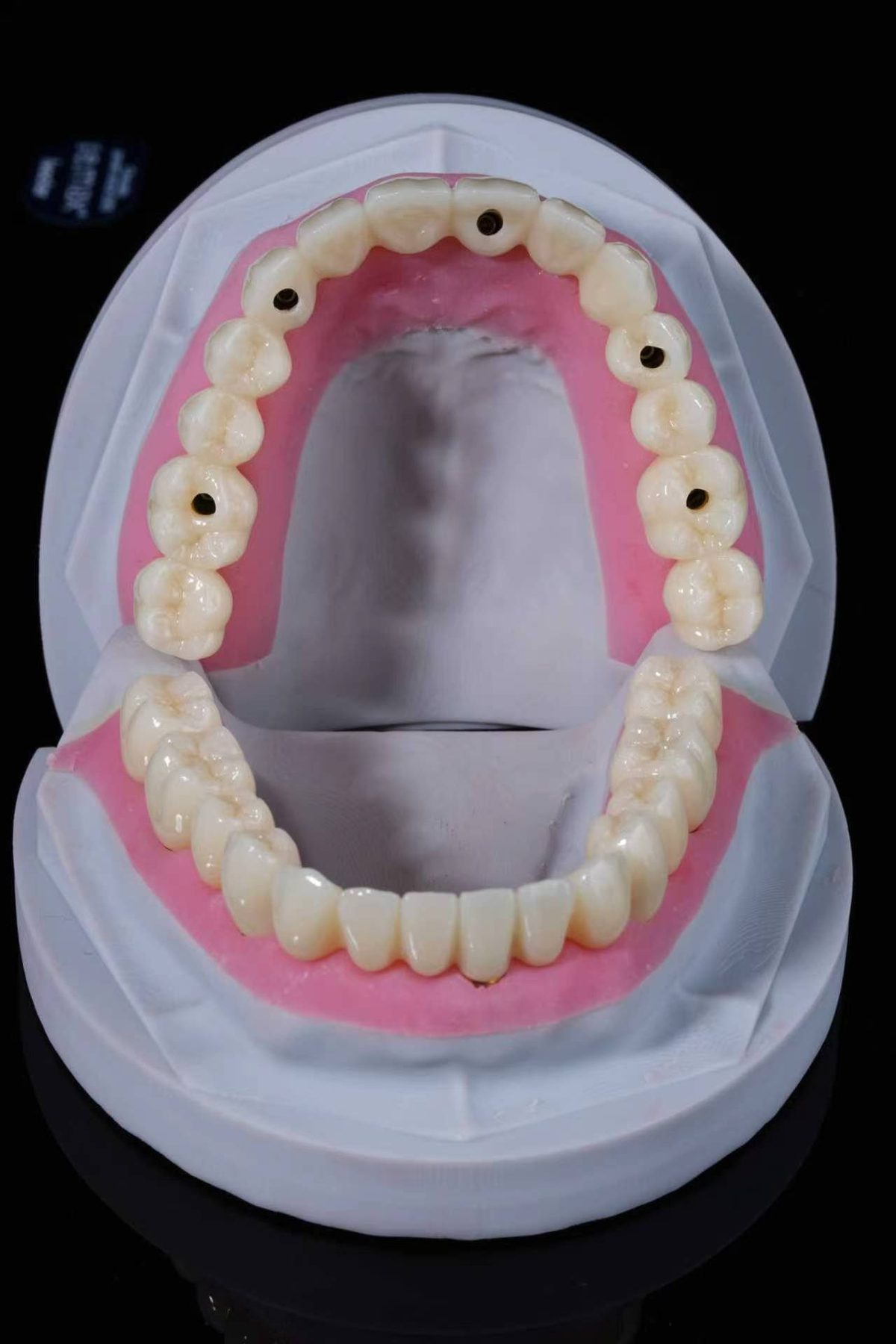 Implant full arch, occlusal view with screw-access channels