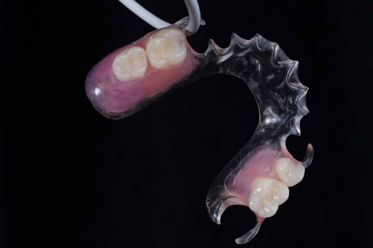 Flexible partial denture, clasp detail